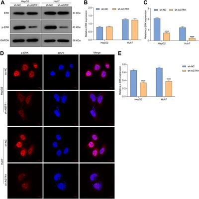 Suppression of AGTR1 Induces Cellular Senescence in Hepatocellular Carcinoma Through Inactivating ERK Signaling